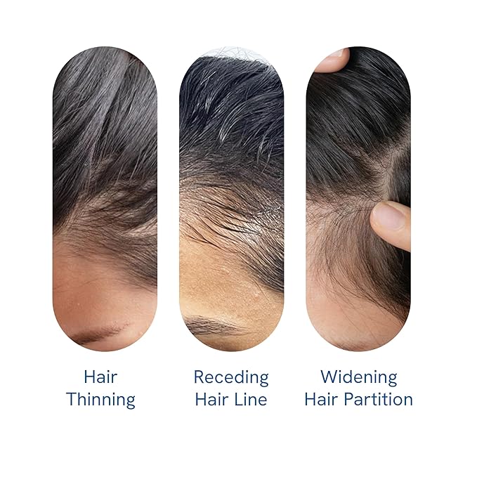 Be Bodywise Rosemary Hair Growth Serum (Roll On)